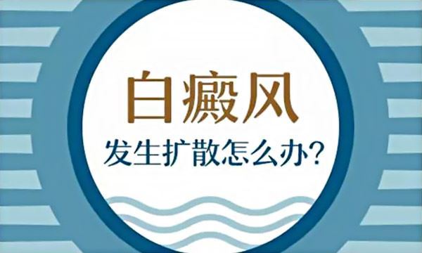 肢端型白癜风病因是什么呢